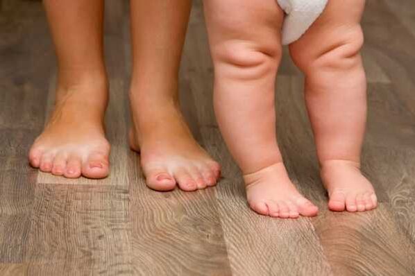 Valgus -vervorming bij kinderen