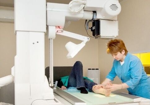 X -RAY -benen